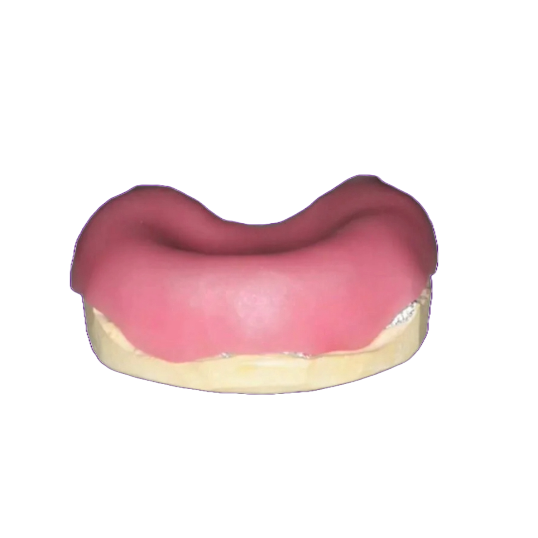 POSCATRAY